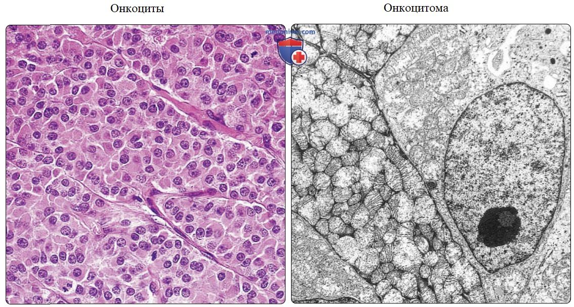 Строение клетки (организация клетки): органеллы, цитоплазма, цитоскелет - с точки зрения гистологии