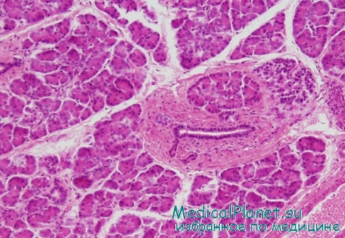 b-клетки поджелудочной железы