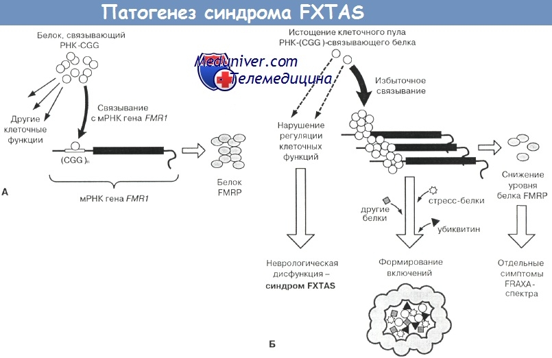 Патогенез синдрома FXTAS
