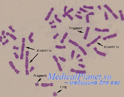 микроскопия хромосом опухоли