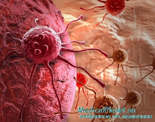 иммунология опухолей