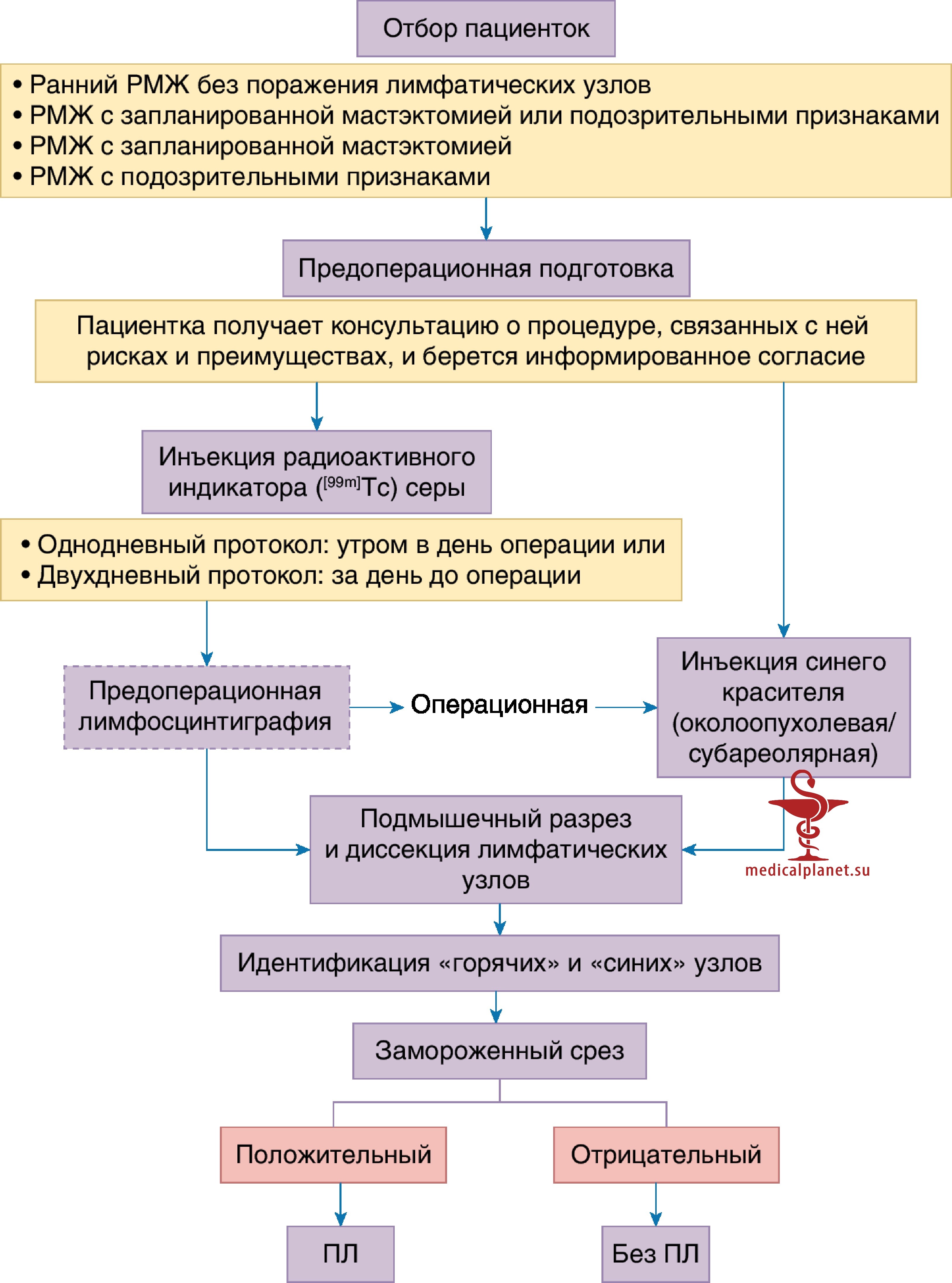 Методики биопсии сигнального лимфатического узла при раке молочной железы