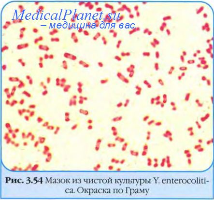 небные миндалины микробы