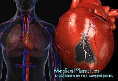 эхокардиография при травме сердца