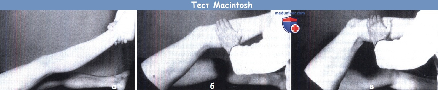 Тест Макинтош (Macintosh)