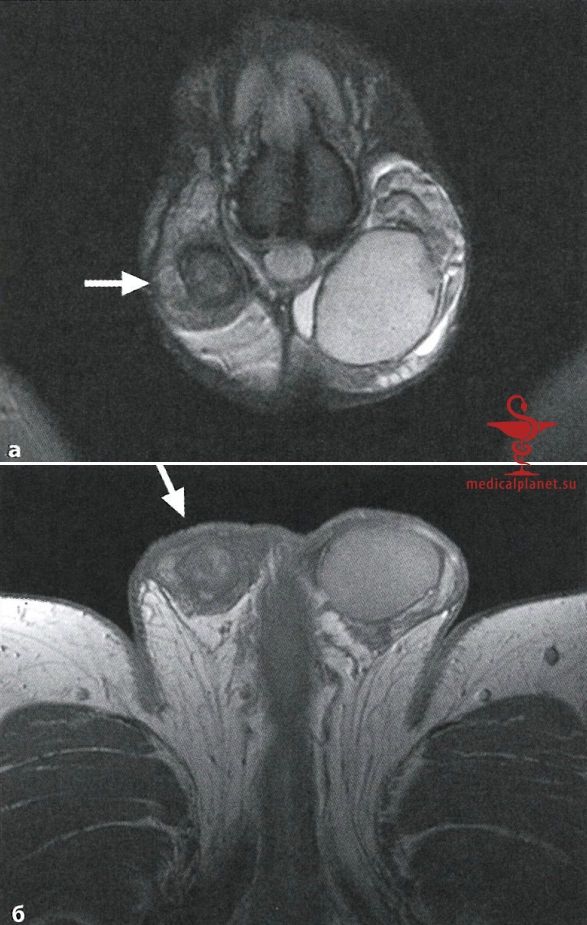 ��� ������� ������� - ����� � �������� � ����� � ��� ���������