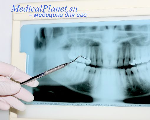 зубы в стоматологии