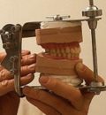 материалы в стоматологии