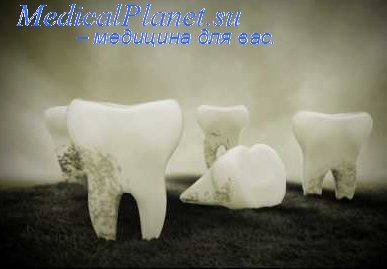 пластмассы в стоматологии