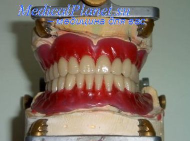 металлы в стоматологии