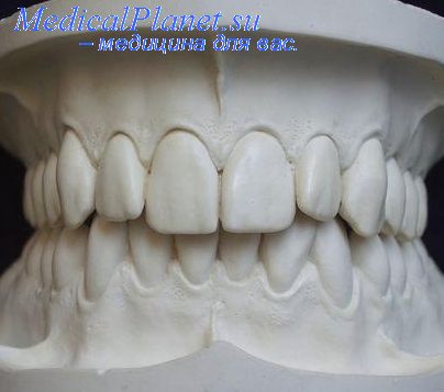 жидкости в стоматологии