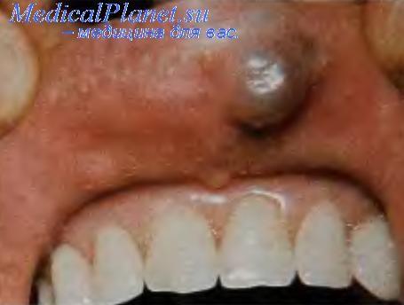 болезни в стоматологии