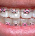 патология в стоматологии