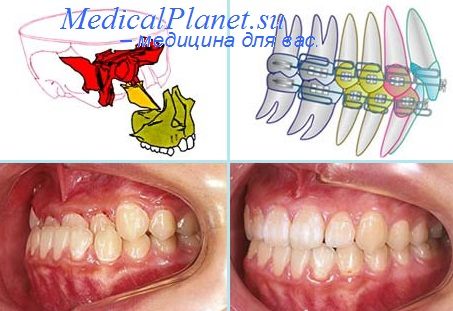 синдромы в стоматологии