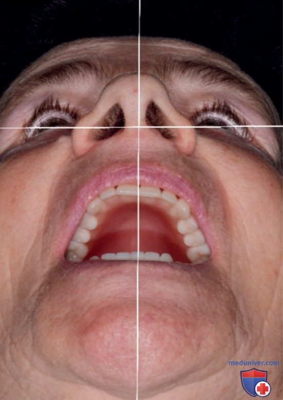 Эстетические каноны, связанные с зубами и лицом