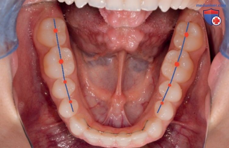 Функциональные дуги и структура зубных дуг в окклюзионной концепции