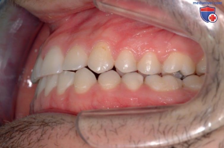 Функциональные области зубных дуг в окклюзионной концепции