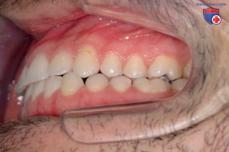 Функциональные области зубных дуг в окклюзионной концепции