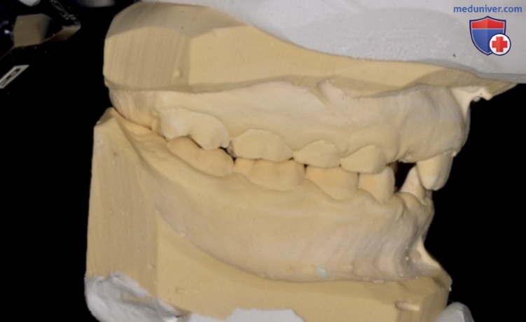 Развитие зубных рядов с точки зрения окклюзионной концепции