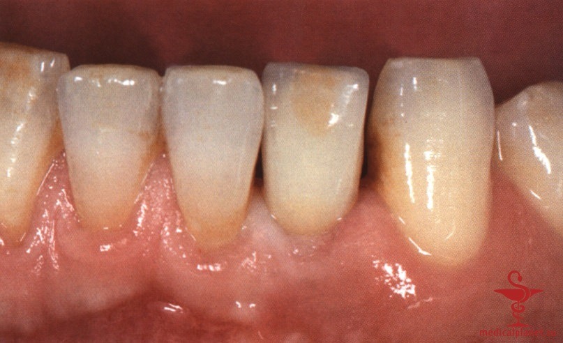 ���������������� ������ ����������� ����������� ����� � ����������� �������� ����