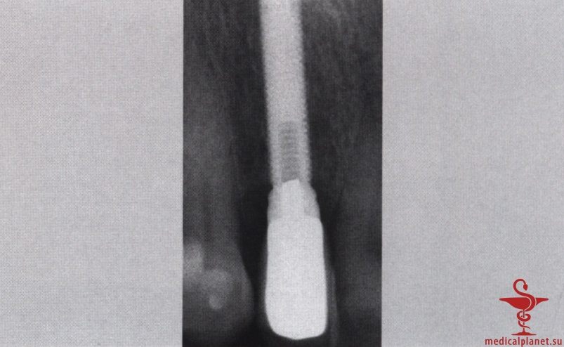 ���������������� ������ ����������� ����������� ����� � ����������� �������� ����