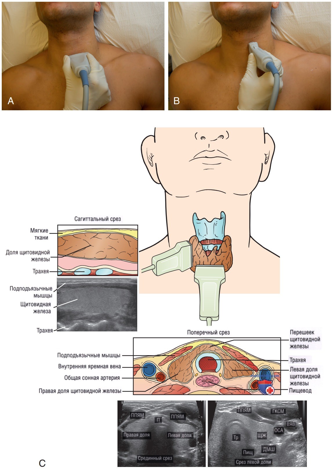 УЗИ щитовидной железы у постели больного (на месте, point-of-care)